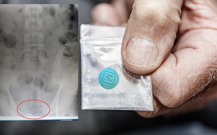 CBP Officers intercept smuggler carrying fentanyl inside his anal cavity